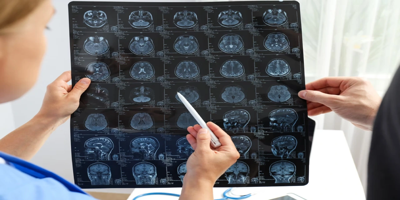 What is a Brain Tumor and How is It Treated?