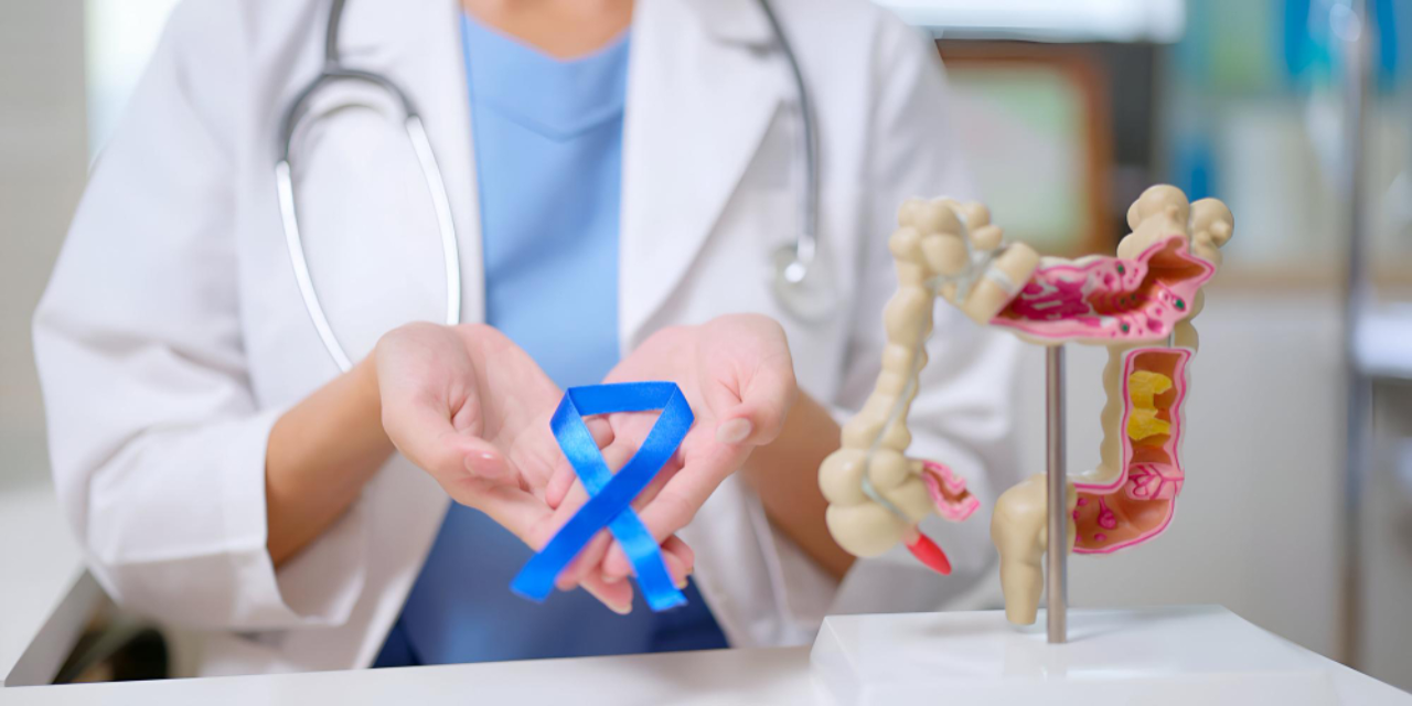 Kolon Kanseri Neden Olur?